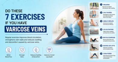 Do These 7 Exercises If You Have Varicose Veins