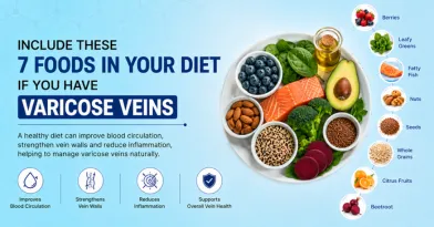 Best Foods for Varicose Veins and Better Circulation