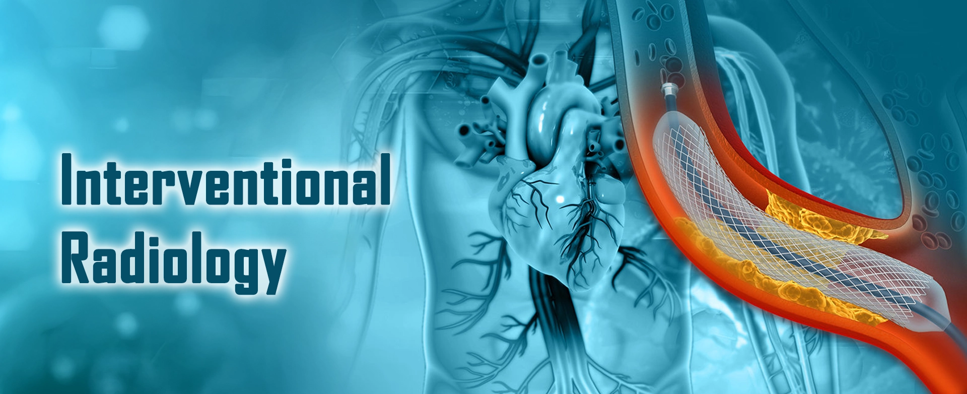 Interventional Radiology