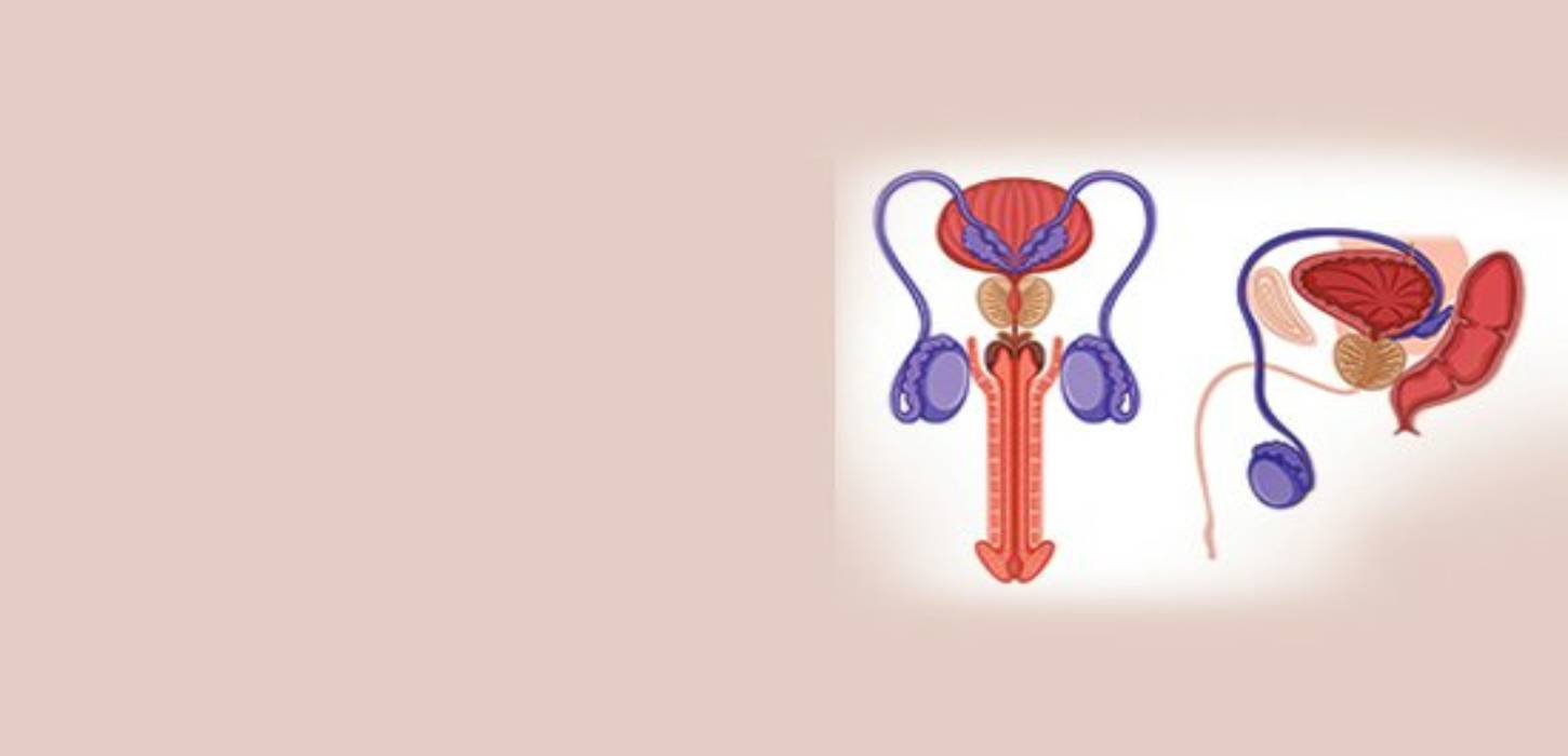 Prostatic Artery Embolization