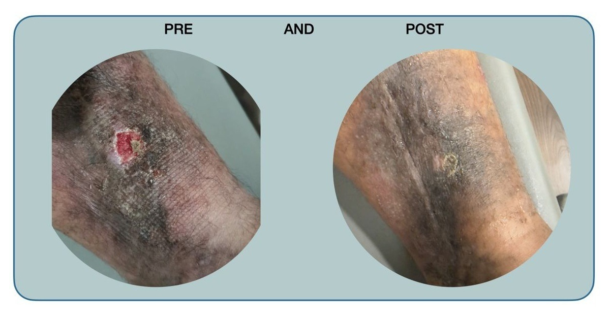 remarkable-healing-within-four-weeks