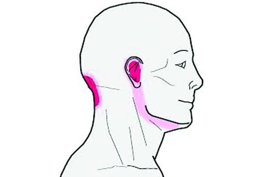 Head, Neck and Eyes